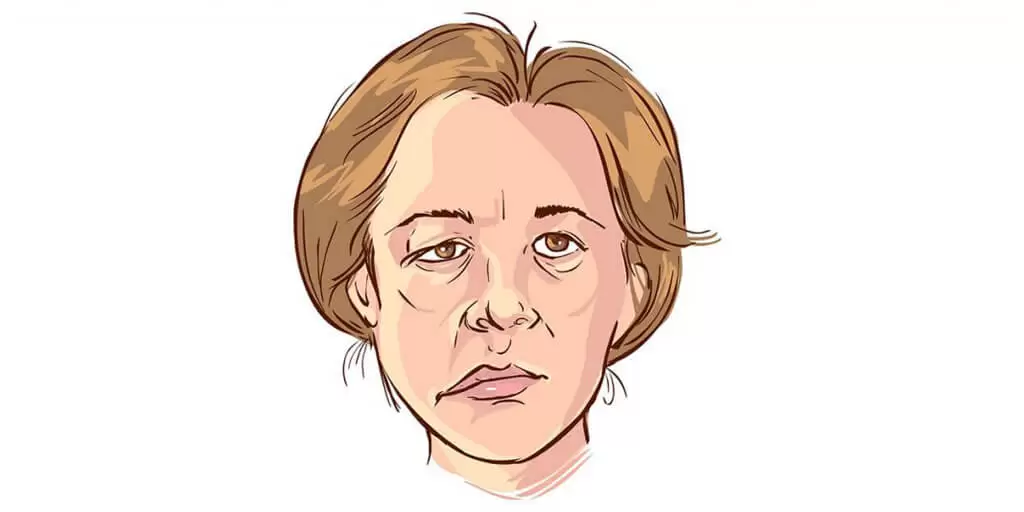 علائم فلج بلز